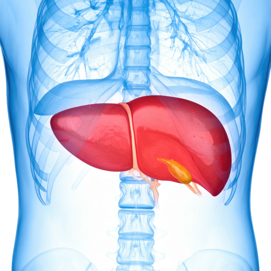 Liver cirrhosis